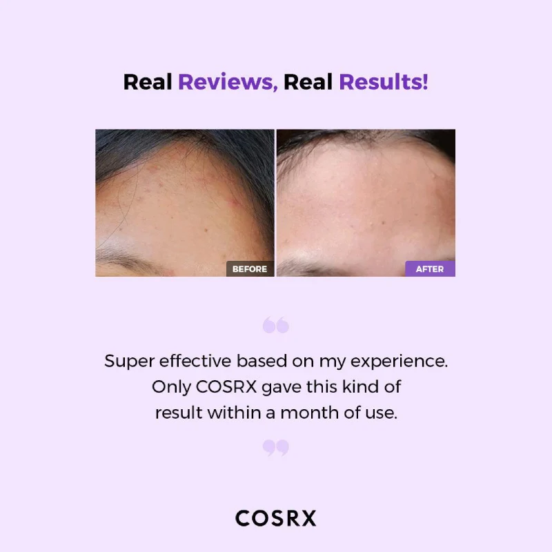 COSRX AHA/BHA Clarifying Treatment Toner 50ml - Image 5